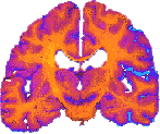 brain