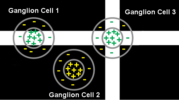 ganglion on off