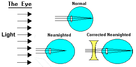 sight