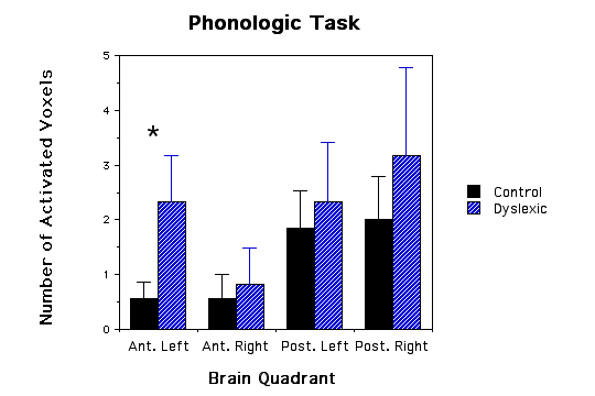 Graph of phonologic.