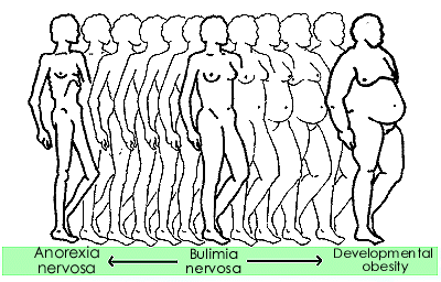 Eating Disorder Spectrum of Physical Characteristics